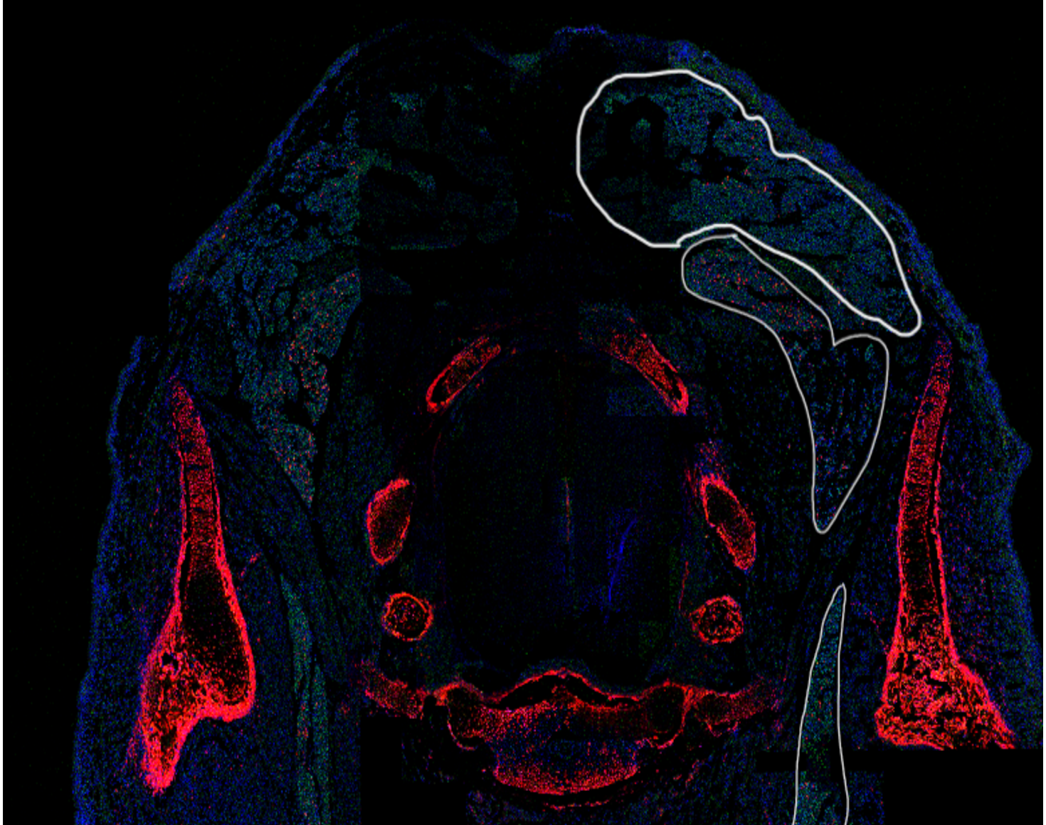 A section of an E15.5 embryo, where the red color corresponds to BMPER+ cells.